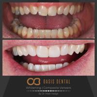 Oasis Dental Studio - Palm Beach image 2